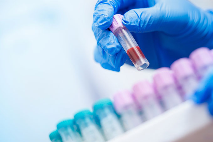 Gloved hand holding a test tubs of blood